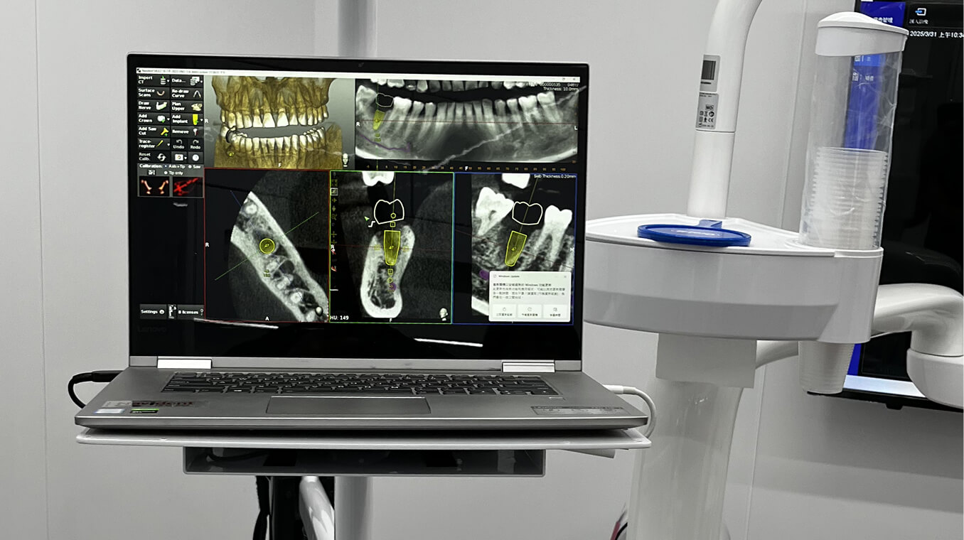 全球領先  科技植牙